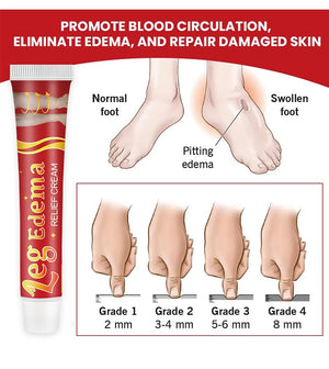 Leg Slimming Massage Cream | Soothing Swelling, Tightening Skin, Auxiliary Care for Reducing Edema (2 Pieces) bobojujuBuy Supplements Australia