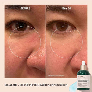 Biossance Squalane + Copper Peptide Rapid Plumping Serum - Face Serum for All Skin Types - Visibly Plumping + Firming Skin, Fine Lines + Wrinkles,