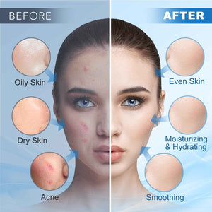 Angeland Jelly Mask for Facials Professional, Hydrating & Moisturizing Peel-Off Natural Gel Face Mask SkinCare, Professional Spa Use Jelly Face Masks,