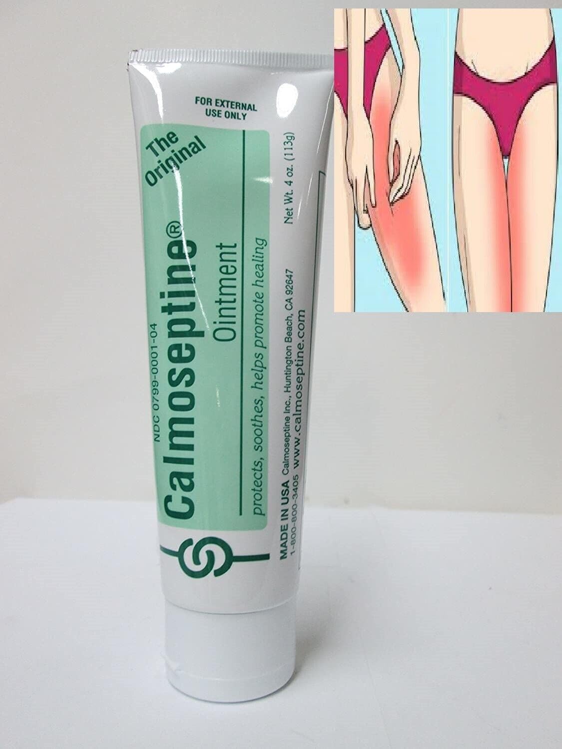 Crema para Infecciones Vaginales Elimina hongos Picazon Irritación Pomada Vagina