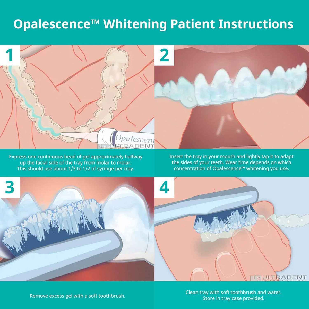 Opalescence 35% CP Mint - Gel Syringes Teeth Whitening - Refill Kit - Carbamide Peroxide Gel. Made by Ultradent