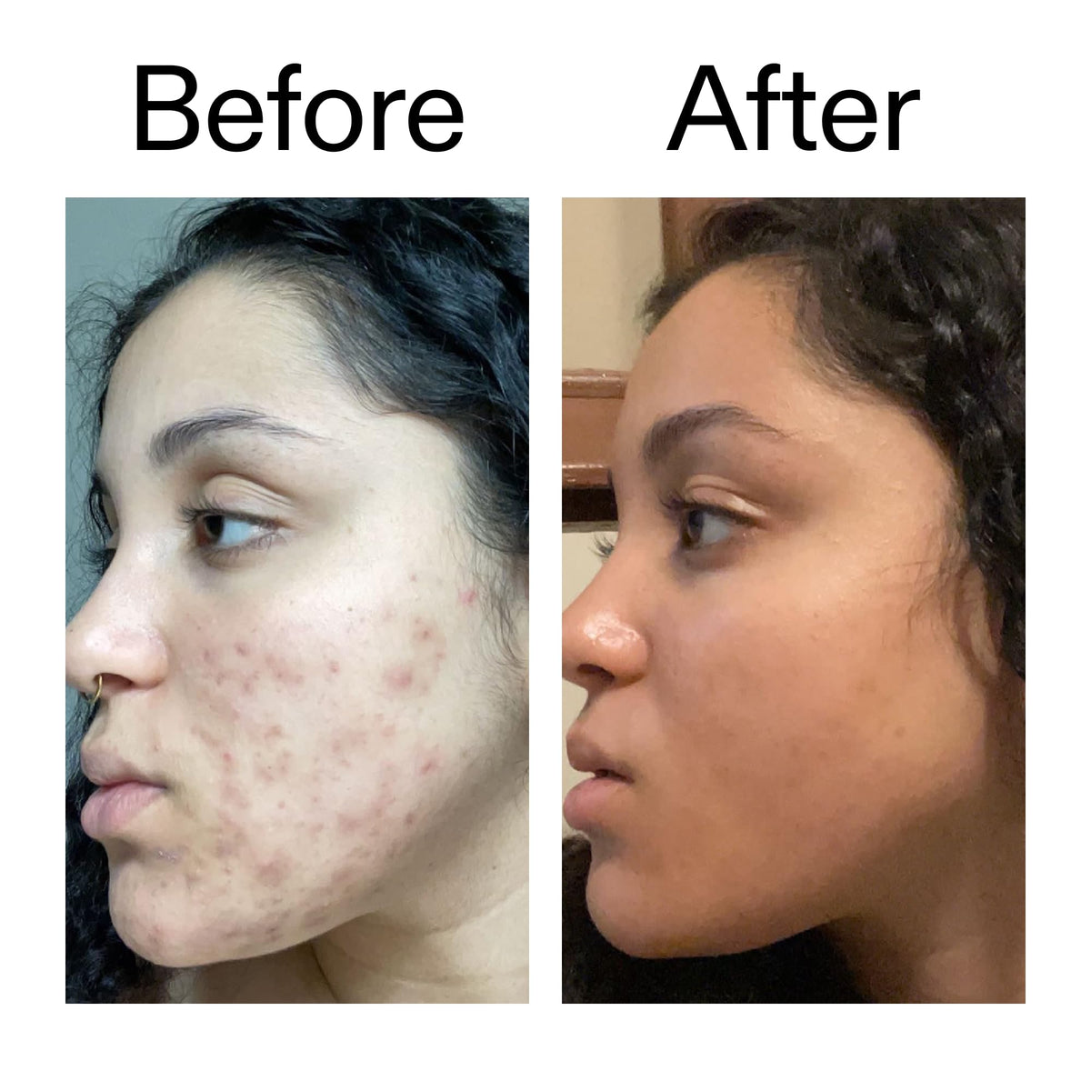 The INKEY List Tranexamic Acid Serum