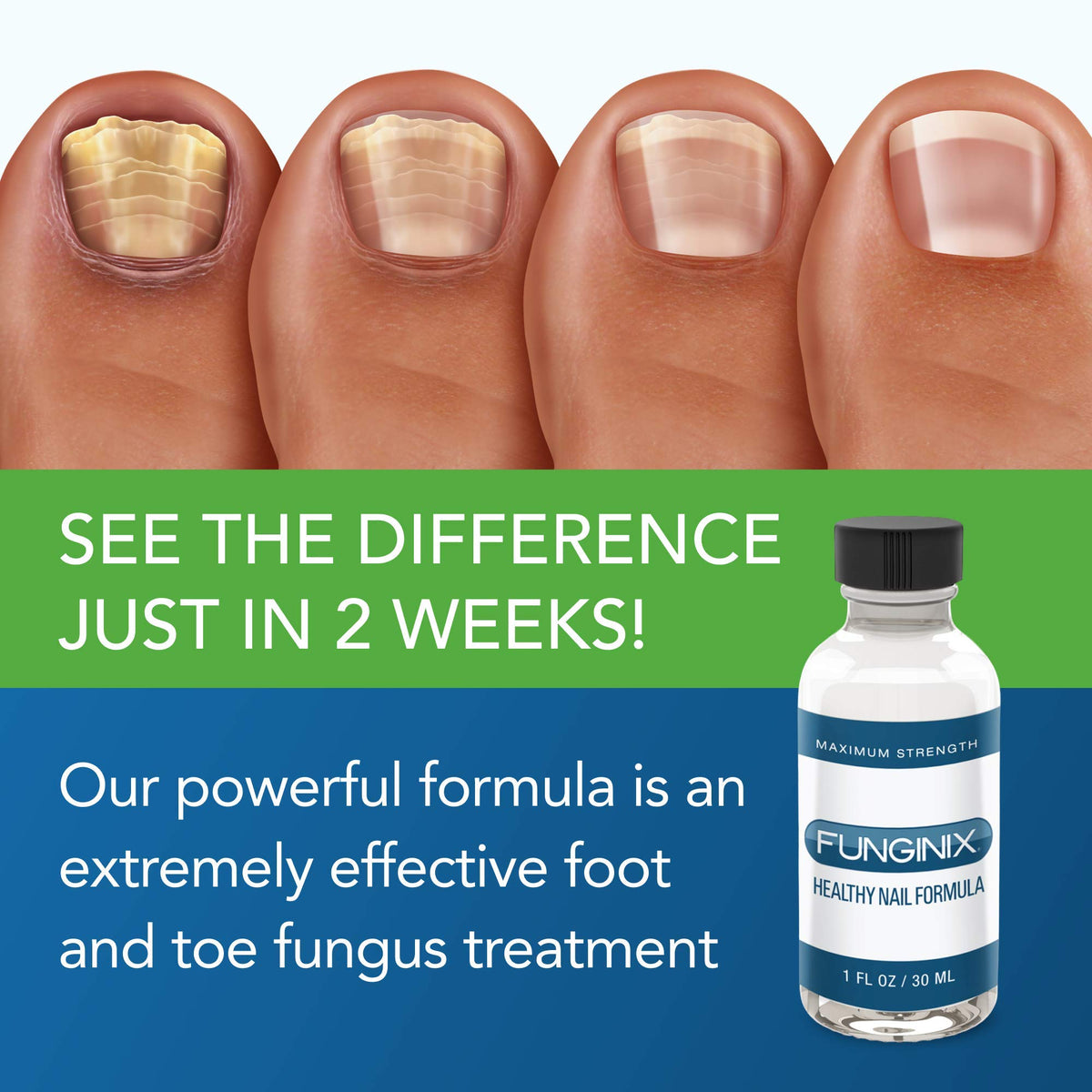 FUNGINIX Healthy Nail Formula - Finger And Toe Fungus Treatment, Made In USA, Foot